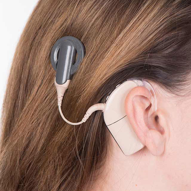 cochlear implants